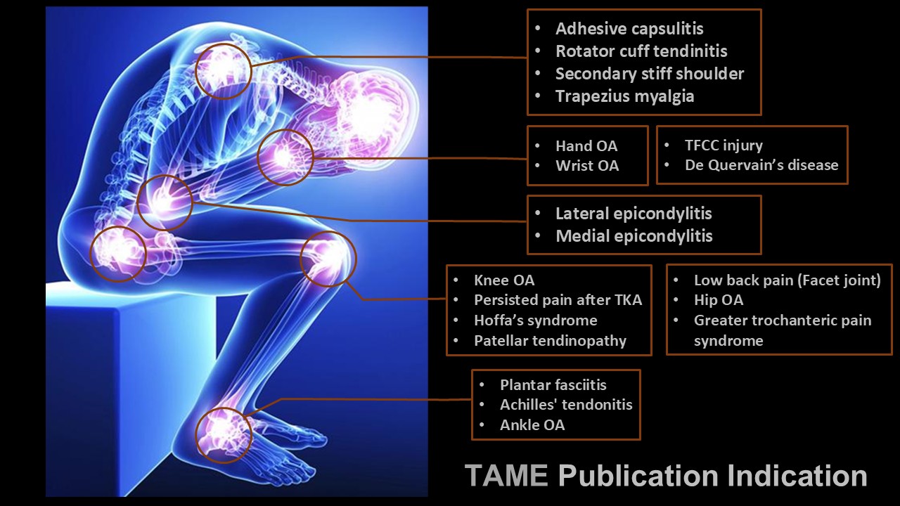 TAME 已發表研究涵蓋的肌肉骨骼疼痛適應症